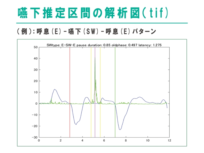 嚥下推定区間の解析図