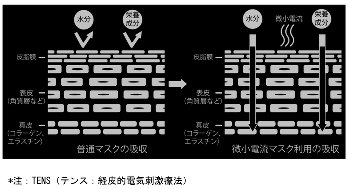 4-TENS図