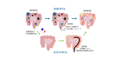 5歳から12歳の自閉スペクトラム症のお子さんを対象に、 新規糞便微生物移植法(新規FMT法)の臨床研究を開始