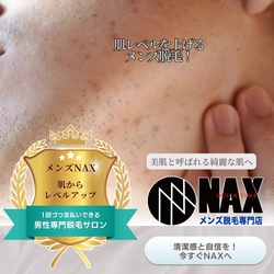 肌レベルアップへ！今こそ始めるメンズ美肌ケア