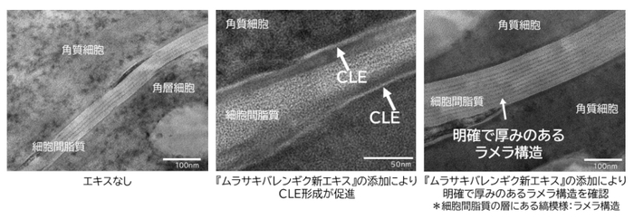 『ムラサキバレンギク新エキス』添加によるCLEとラメラ構造の変化