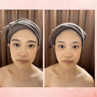 ビフォーアフター