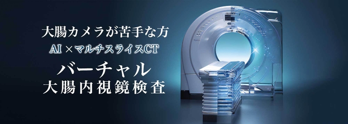 AI×マルチスライスCT バーチャル大腸内視鏡検査を開始