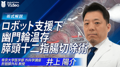 ロボット支援下 幽門輪温存膵頭十二指腸切除術