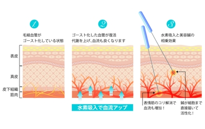 ゴースト血管