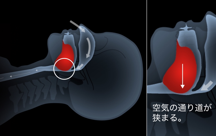 仰向け寝構造イメージ