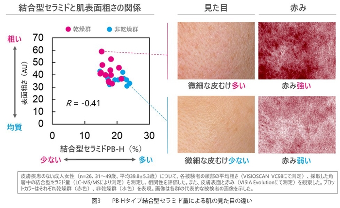 図3　　PB-Hタイプ結合型セラミド量による肌の見た目の違い