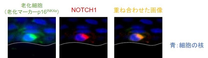 図2 老化細胞はNOTCH1を発現している