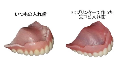 人の入れ歯は使えない！防災意識の高まりで注目の予備入れ歯　 3Dプリンターで完コピに。開始から500個突破！