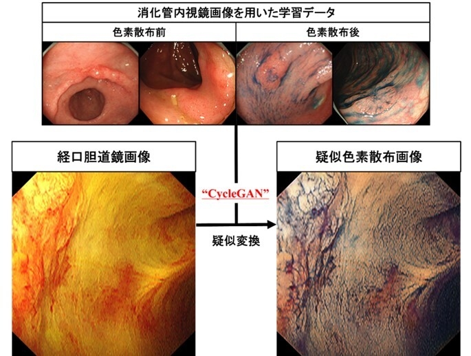 CycleGANを用いた疑似色素散布画像