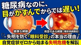健診で「血糖値が高め」と言われたら、次に行くのは眼科かも？