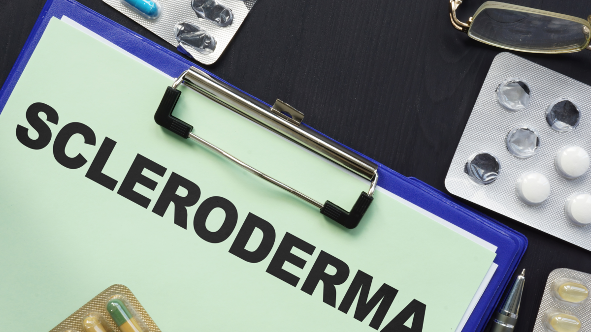 全身性強皮症治療市場 - 現在の業界の数値を詳細に分析し、成長機会と2028年までの成長を予測