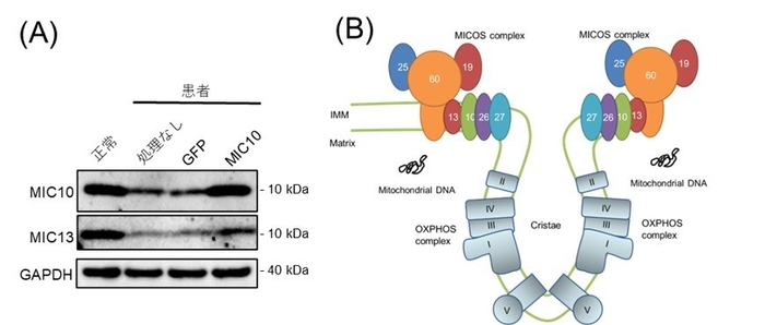 図3　MIC10タンパク質の消失およびMICOS複合体：（A）患者由来線維芽細胞では、MIC10タンパク質およびMIC13タンパク質が減少していました。それは、MICOS10 遺伝子を細胞内に戻すことで回復されました。（B）MICOS複合体は、ミトコンドリア内膜（IMM）に存在し、MIC10,13,19,25,26,27,60から構成されています。これらは、クリステ構造を形作るのに重要な役割を担っています。