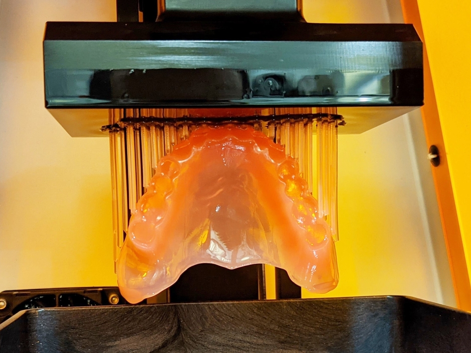 3Dプリンターで歯茎ができる様子
