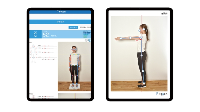 Posen(ポーズン)測定イメージ