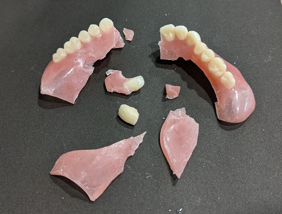 3. T様-1 犬に噛まれてズタボロに