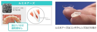 貼るホワイトニングの「ルミネアーズ」