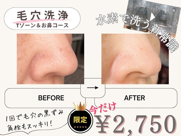 限定キャンペーン