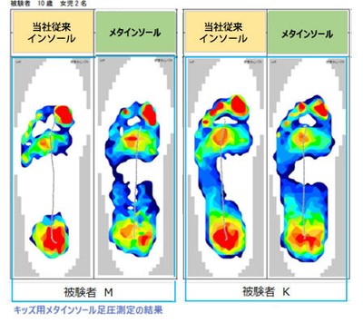 足圧分散図