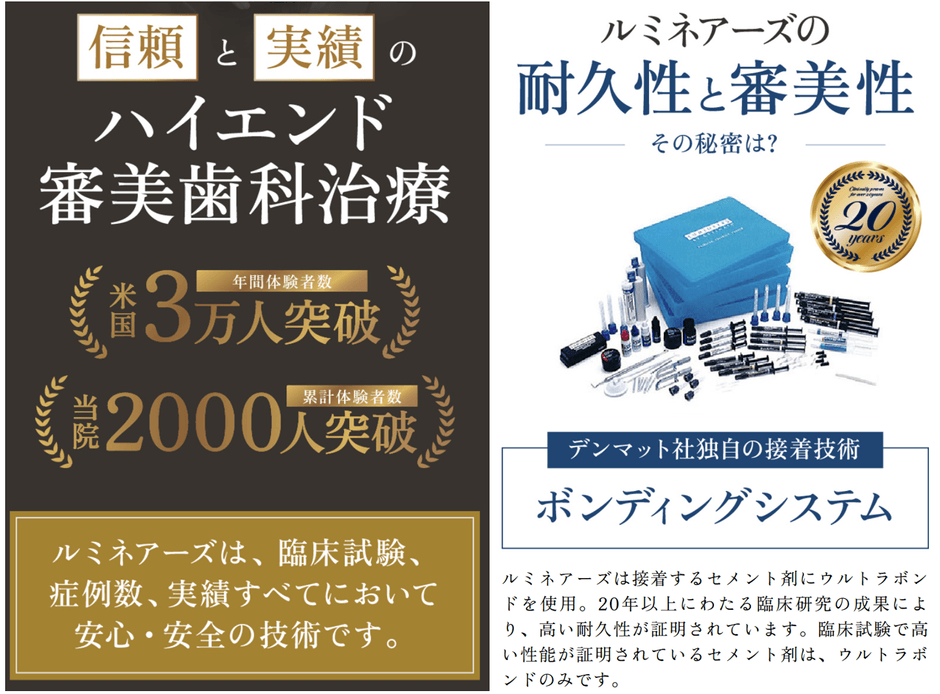 ハリウッドスマイルの白さ「ルミネアーズ」