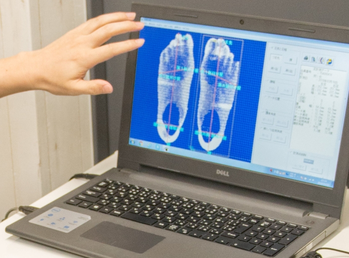 足の状態を見える化