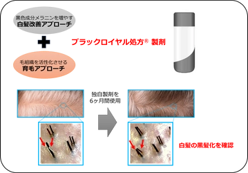 富士産業、育毛アプローチを組みあわせた独自製剤による 白髪改善効果に関する研究結果を公開