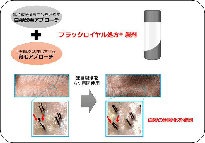 図1：2つのアプローチにより白髪を改善