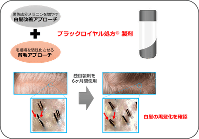 図1:2つのアプローチにより白髪を改善