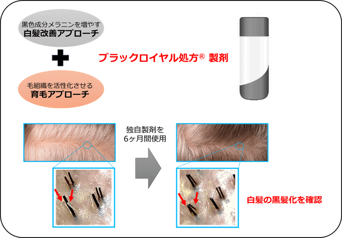 図1:2つのアプローチにより白髪を改善