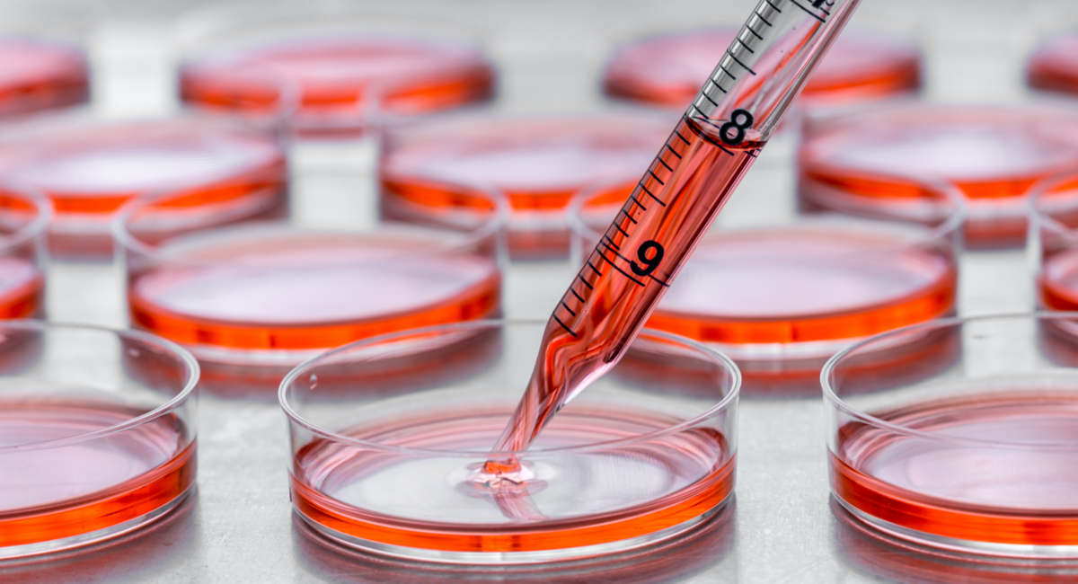 細胞培養市場は、2026年までに429億米ドル以上、年平均成長率11.8%に達する見込み