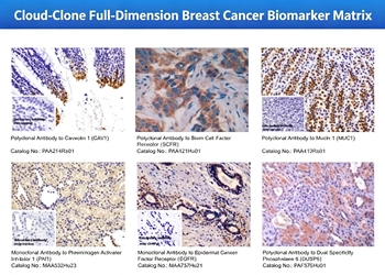 Cloud-Clone、技術革新を推進し、 乳がん精密研究の将来的な発展の道筋を描く
