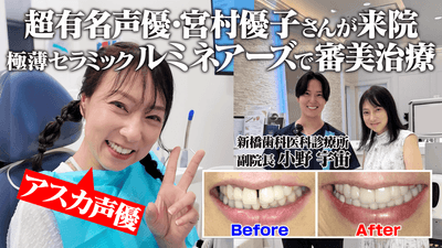 人気声優・宮村優子さんが新橋歯科医科診療所で「ルミネアーズ」を体験