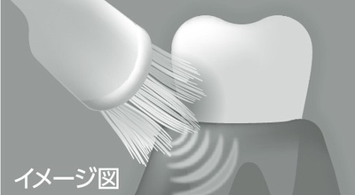 図2:付替システマハグキプラス