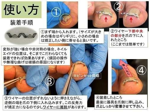 「ネイルエイド」の使い方(装着手順)