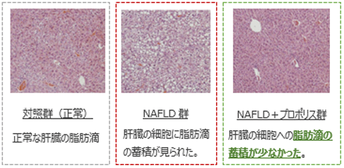 【肝臓組織の脂肪滴蓄積の様子】