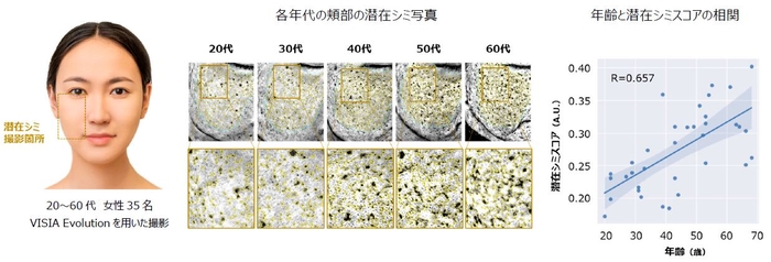 図1　加齢によるメラニンの蓄積と潜在シミスコアの上昇