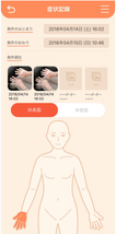 アプリ画面　症状の写真や発生日時を記録(イメージ)