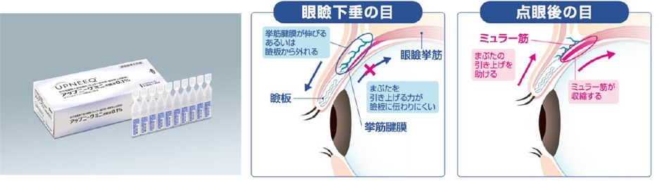 作用機序