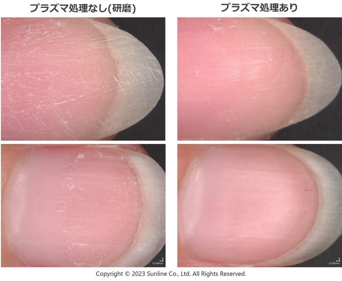 図3.ネイルオフ時の爪甲外観の比較