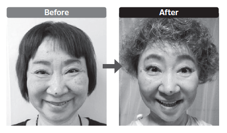 体験者のビフォーアフター(本文より)