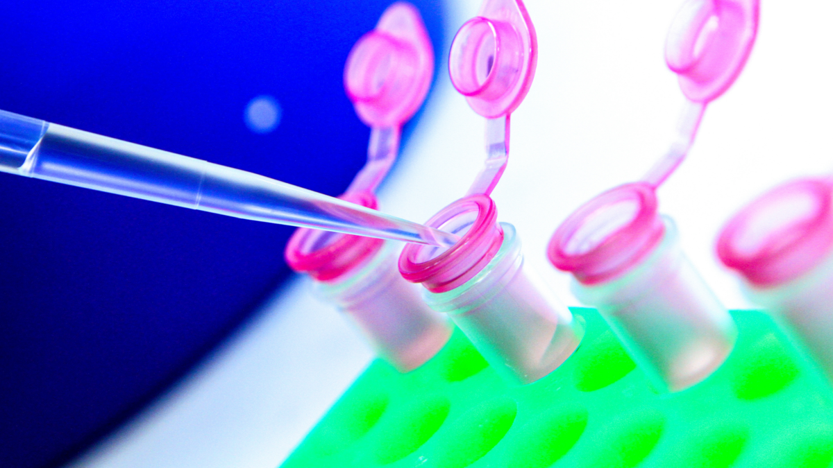 DNA＆RNAバンキングサービスの市場規模は2028年までに94.3億米ドルに達する見込み