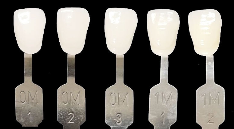 ハリウッドスマイルの白さ「ルミネアーズ」