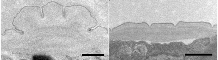 図2. マツ細胞食ステージの発達した側翼(左)と菌食ステージの滑らかな側翼(右)の電子顕微鏡像。スケールバーは500 nm。
