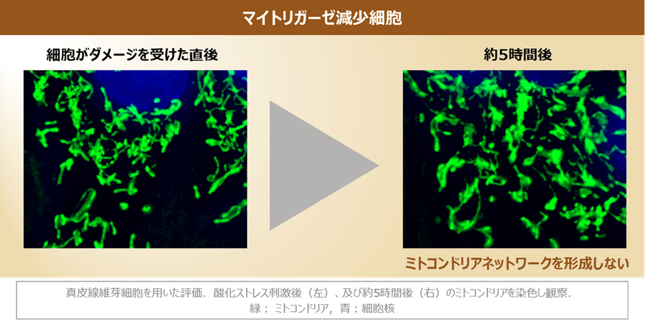 図3 マイトリガーゼの減少によるミトコンドリアネットワーク形成の阻害