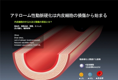 <アテローム性動脈硬化のメカニズム>