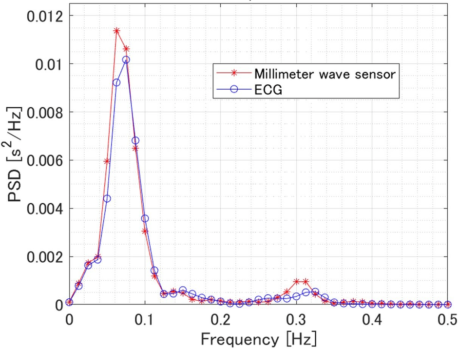 心拍変動スペクトル