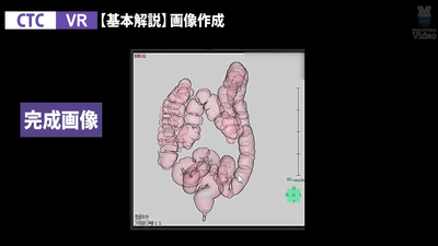 3DCT CTC