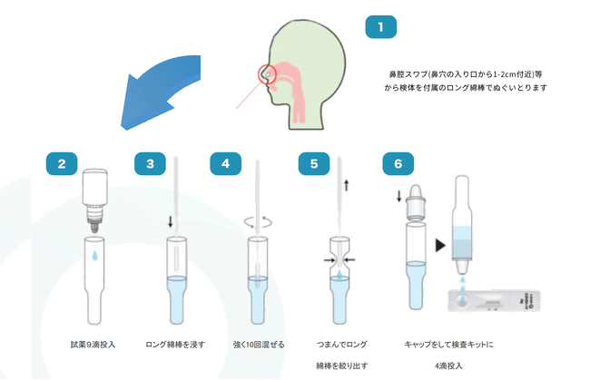 検査手順