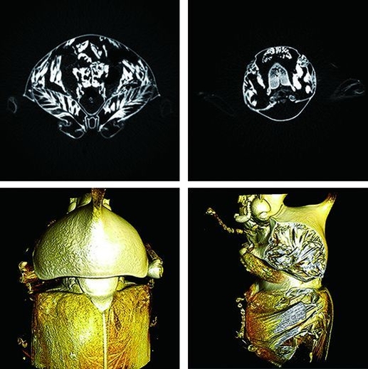 CTスキャン画像_協力:島津製作所