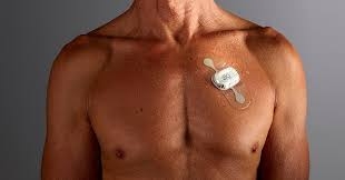 心電図パッチとホルターモニターの市場は、2022年から2030年までの予測期間において、合計で年間20.5の成長率を示し、2030年には